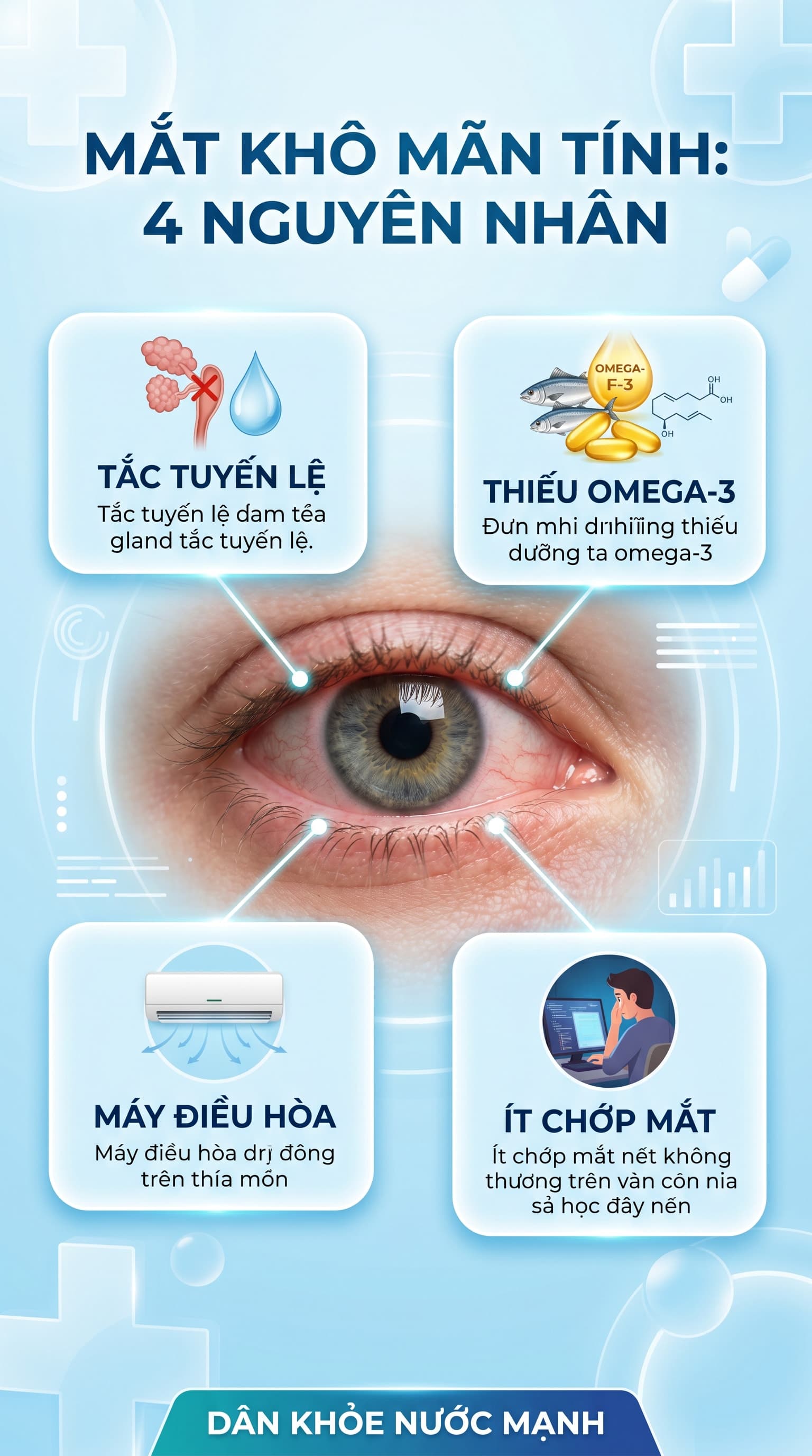 Mắt Khô Mãn Tính: 4 Nguyên Nhân Ẩn Mình Đằng Sau Lọ Thuốc Nhỏ Mắt Vô Thưởng Vô Phạt