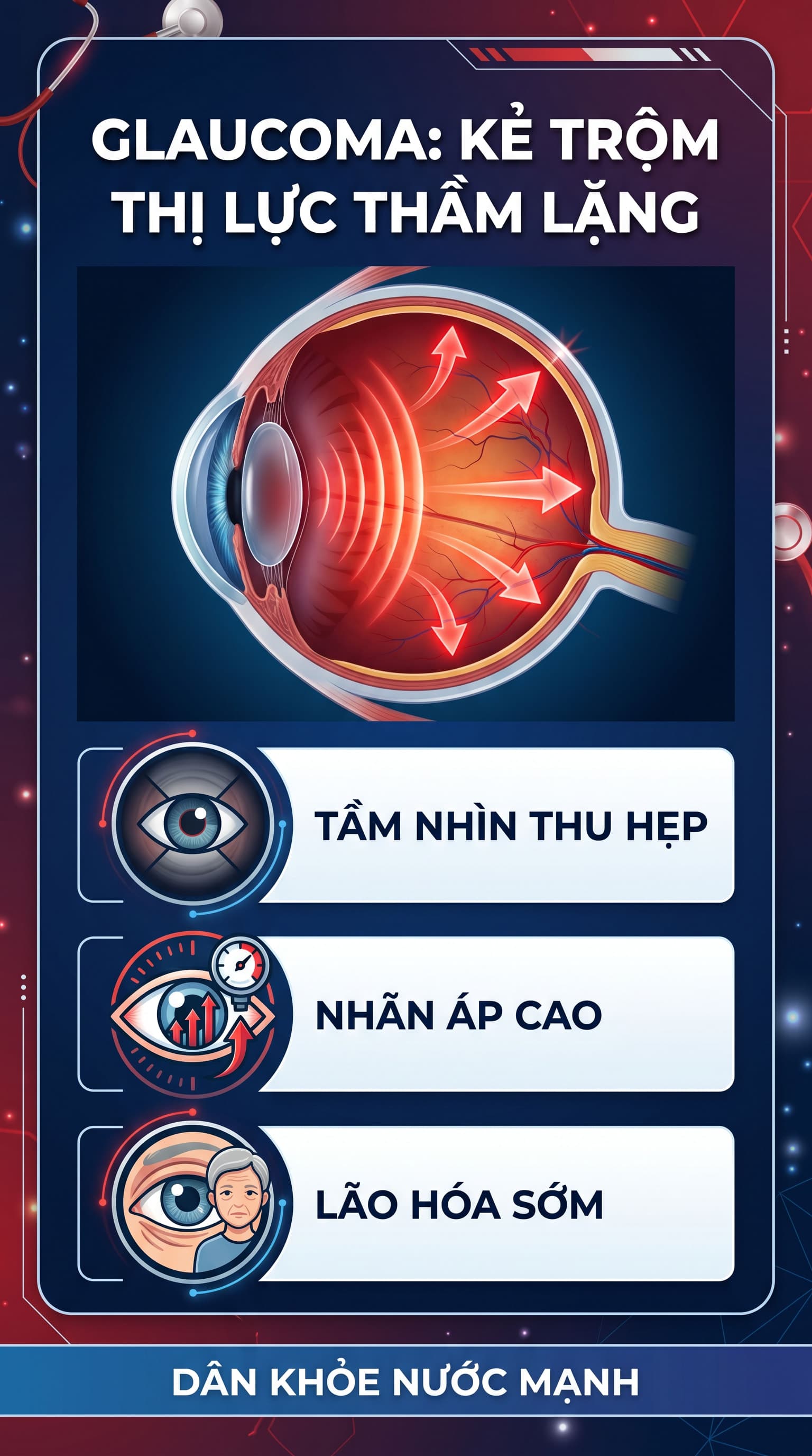 Glaucoma: Kẻ Trộm Thị Lực Thầm Lặng Và Cách Để Bạn Không Bao Giờ Trở Thành Nạn Nhân